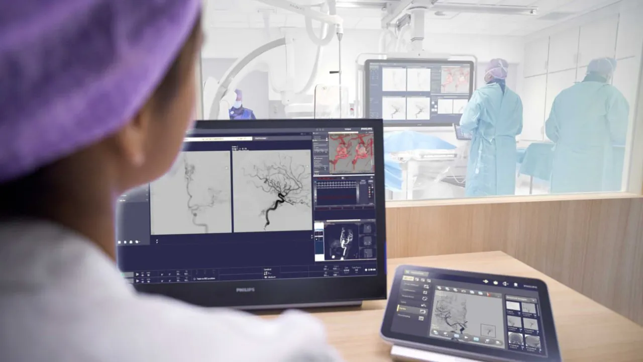 Transformasi Kesehatan Nasional: Cathlab Philips Siap Dukung Layanan Minimal Invasif di Seluruh Indonesia